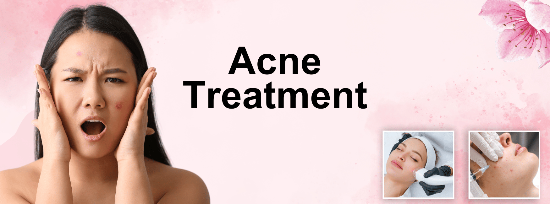 Acne Treatment in Janakpuri