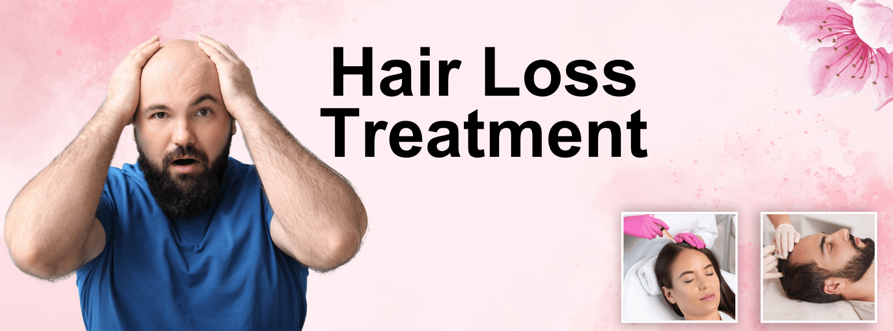 Hair Loss Treatment in Janakpuri