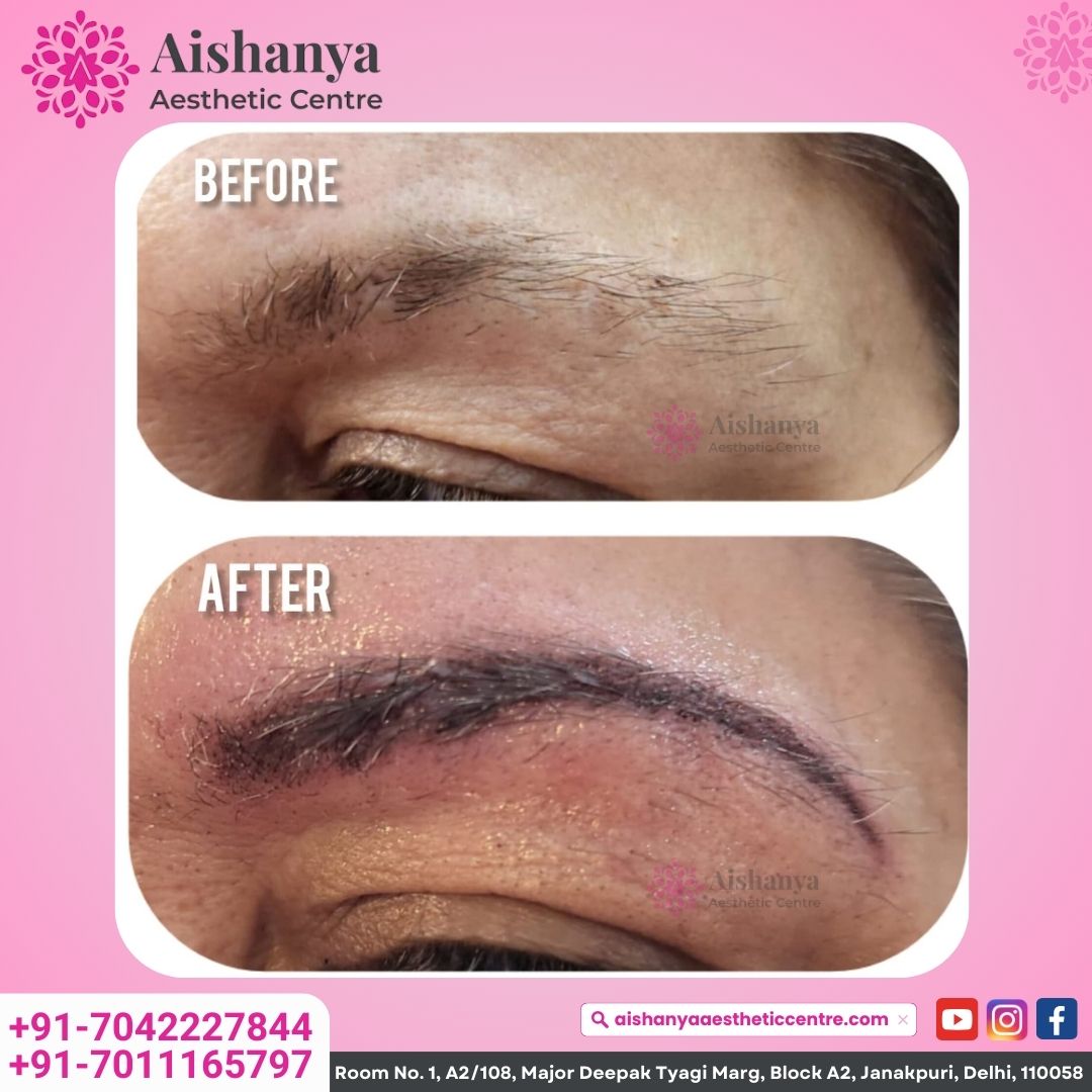 Aishanya - Best Plastic and Cosmetic Surgery Clinic in Delhi | Rhinoplasty, Melasma & Hydra Facial in Delhi;