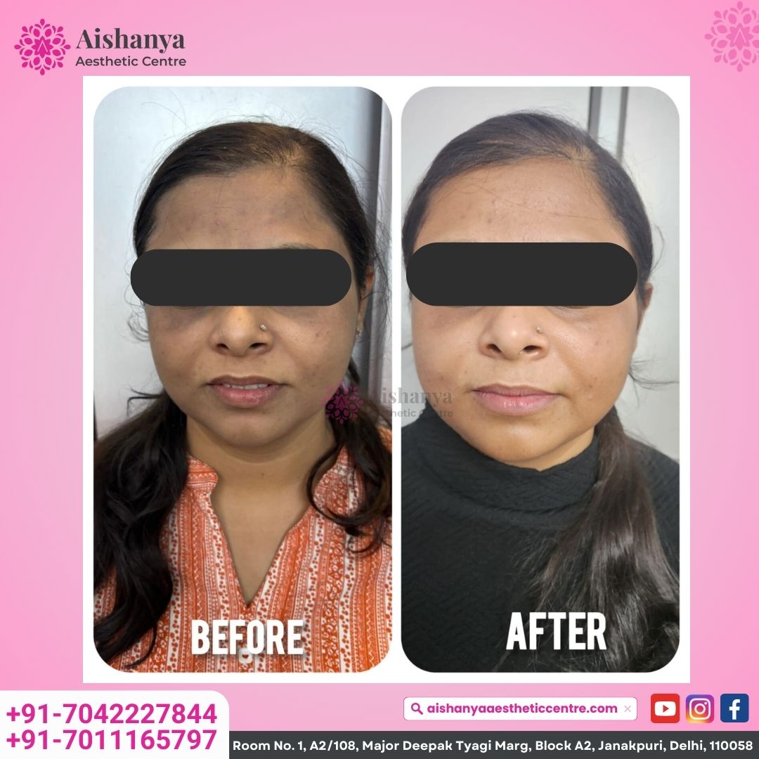 Aishanya - Best Plastic and Cosmetic Surgery Clinic in Delhi | Rhinoplasty, Melasma & Hydra Facial in Delhi;