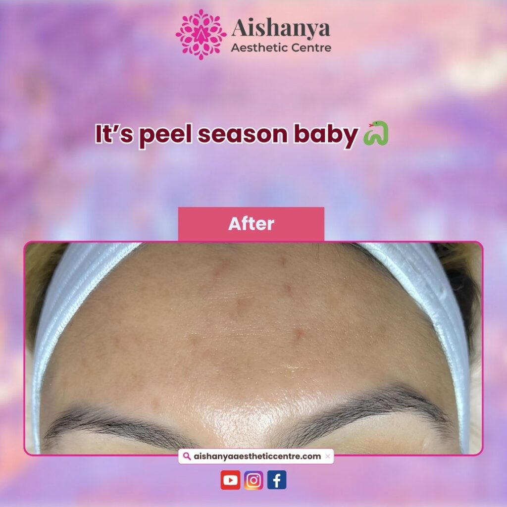 Aishanya - Best Plastic and Cosmetic Surgery Clinic in Delhi | Rhinoplasty, Melasma & Hydra Facial in Delhi;