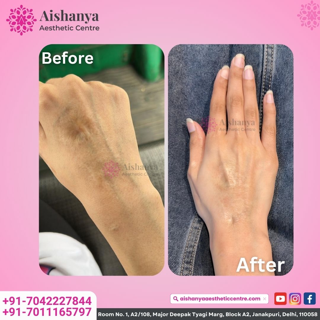 Aishanya - Best Plastic and Cosmetic Surgery Clinic in Delhi | Rhinoplasty, Melasma & Hydra Facial in Delhi;